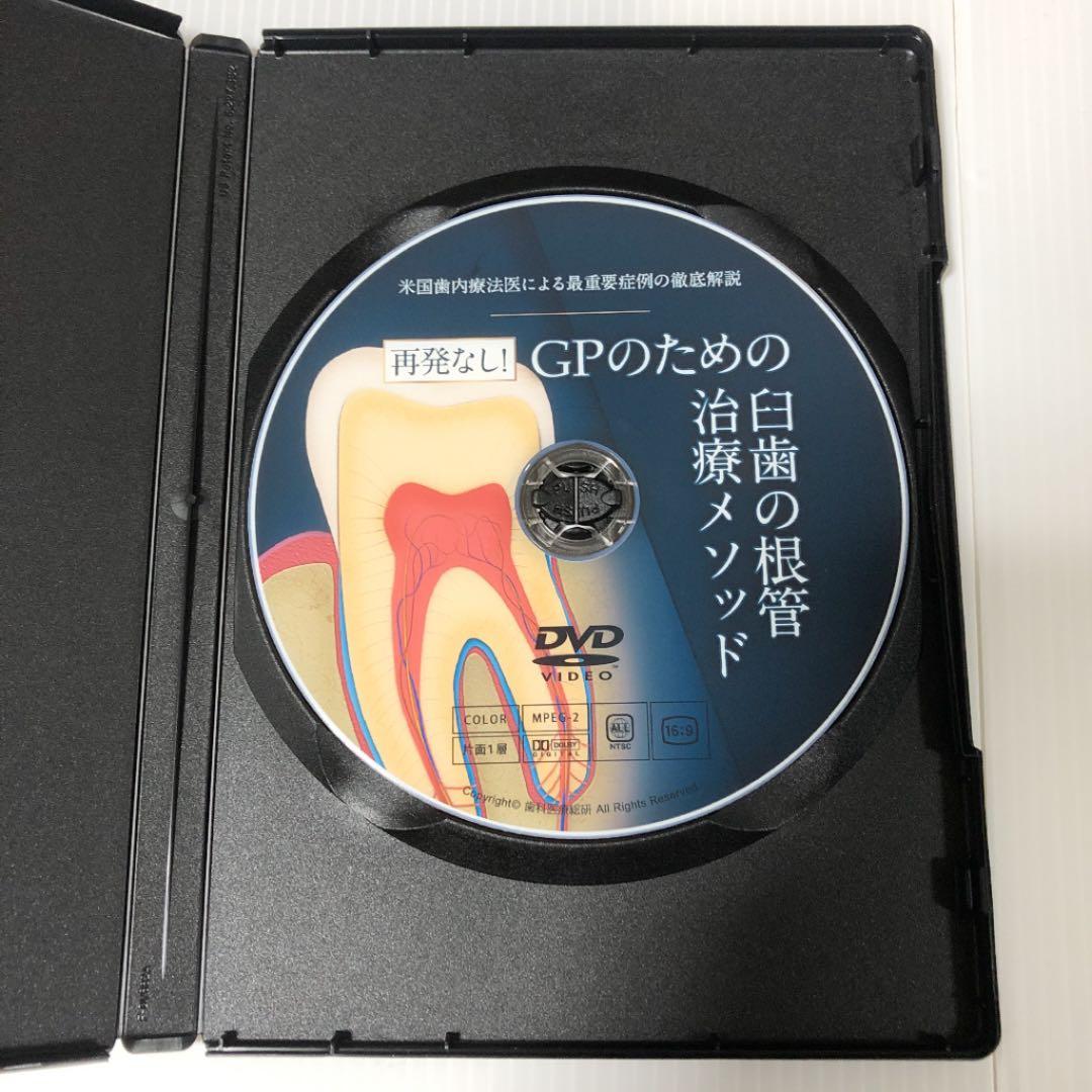 米国歯内療法医による最重要症例の徹底解説 再発なし！GPのための臼歯の根管治療