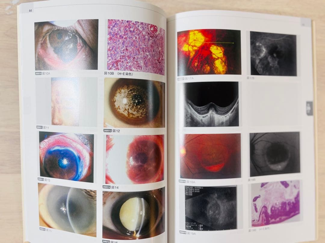 【新品・未使用】眼科専門医への最短コース 問題集