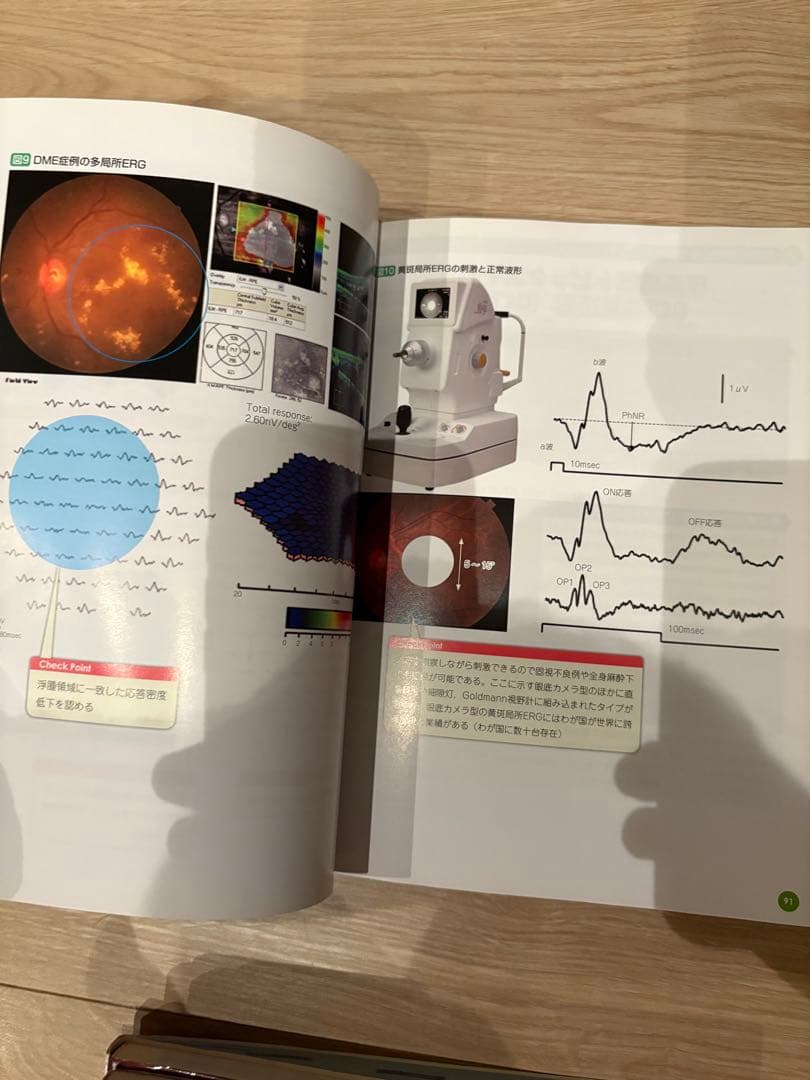 知っているようで知らない新しい糖尿病網膜症診療