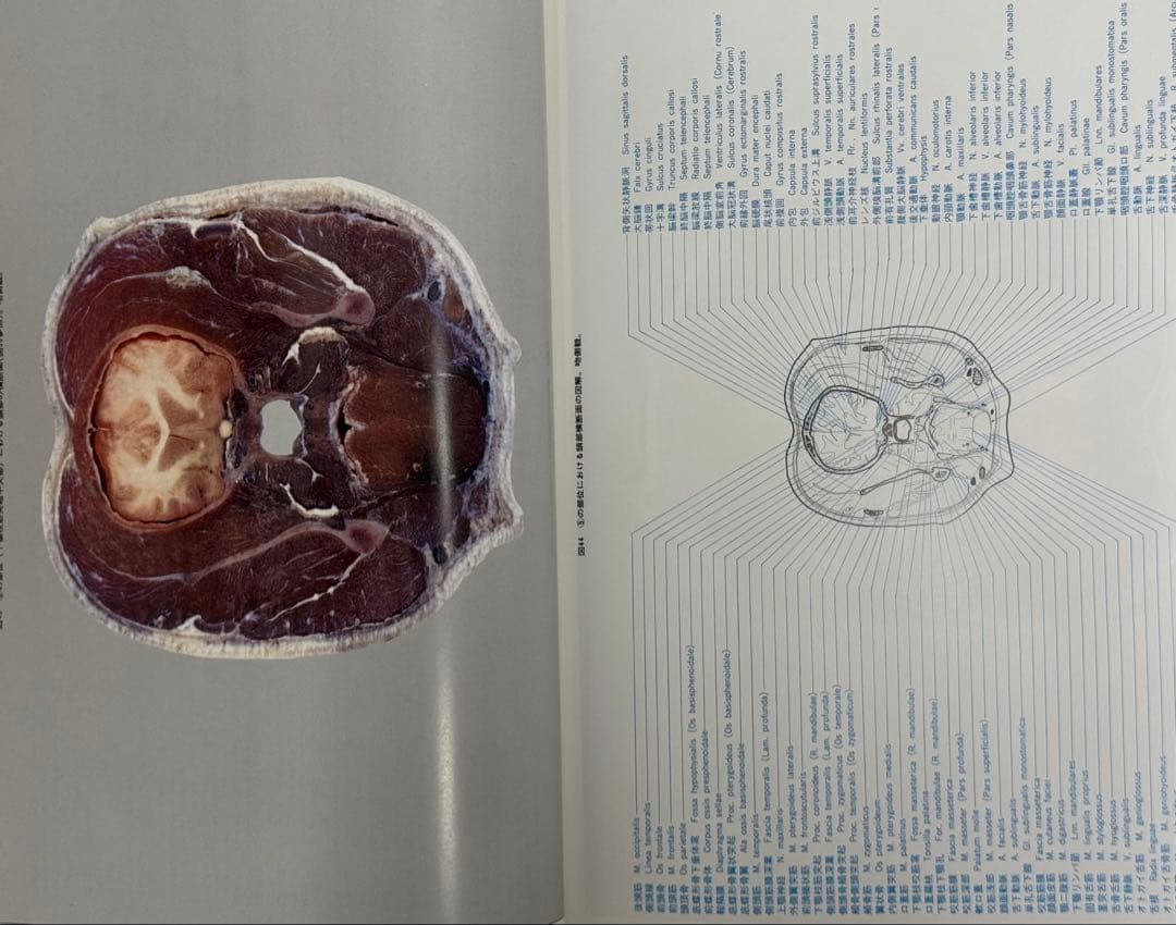 犬の断層解剖と画像Atlas of Imaging Anatomy of the