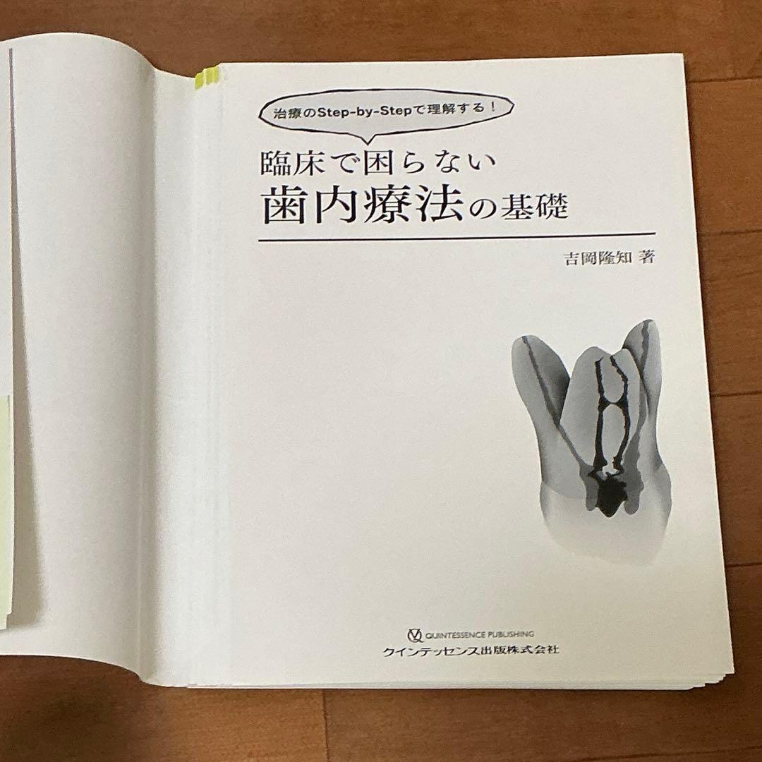 【裁断済】臨床で困らない歯内療法の基礎-治療のＳｔｅｐ-ｂｙ-Ｓｔｅｐで理解する