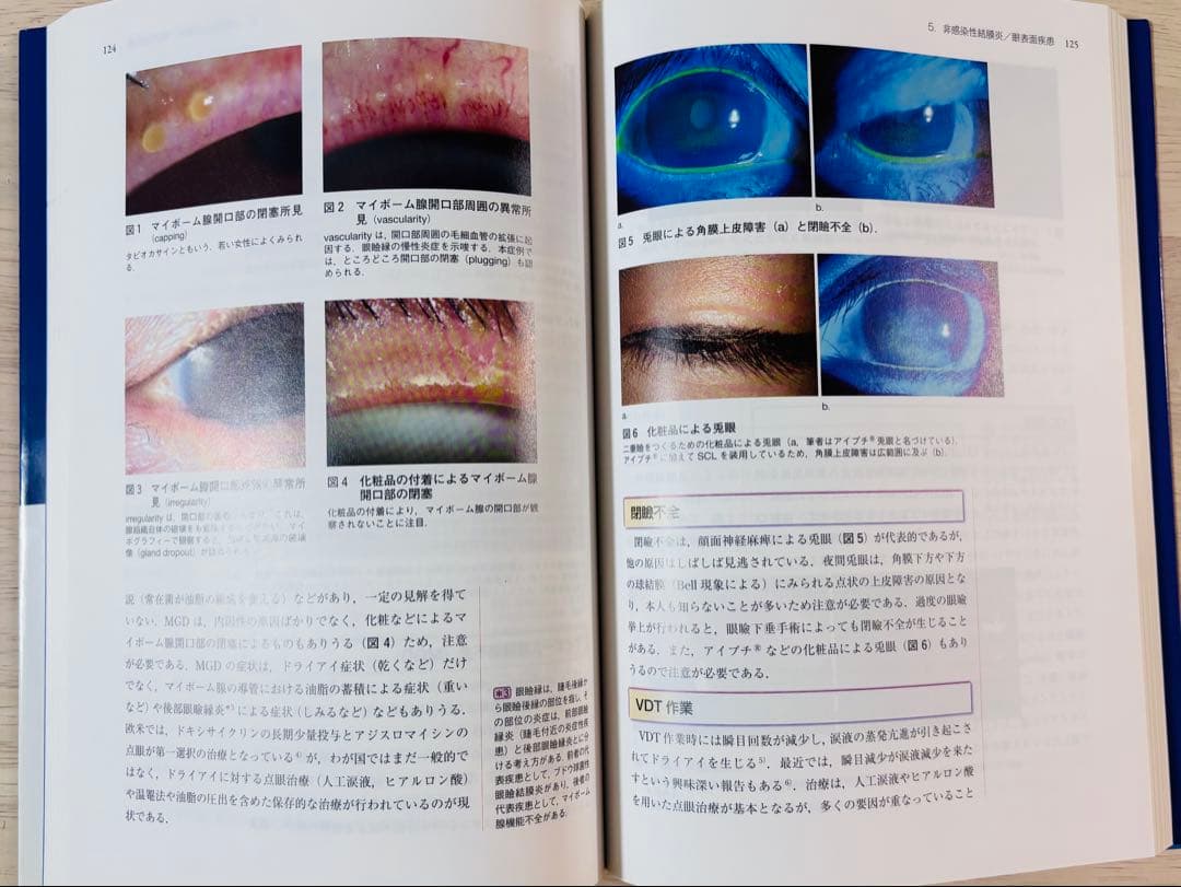 【新品・未使用】眼科診療クオリファイ 2 結膜炎オールラウンド