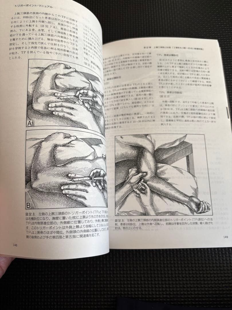 トリガーポイント・マニュアル 第Ⅱ巻　美品