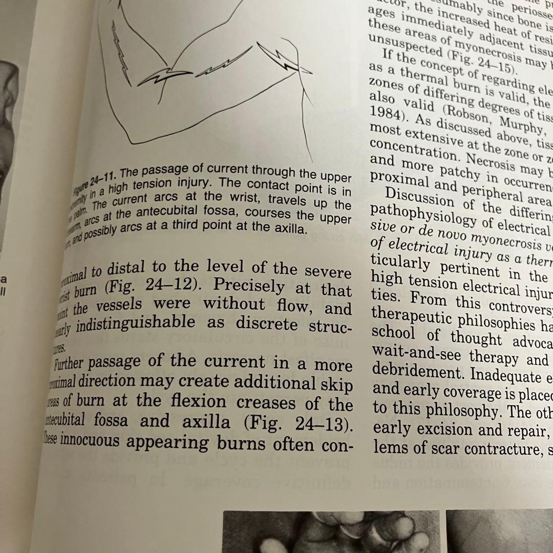 洋書　PLASTIC SURGERY 全8巻 McCarthy 1-8 形成外科