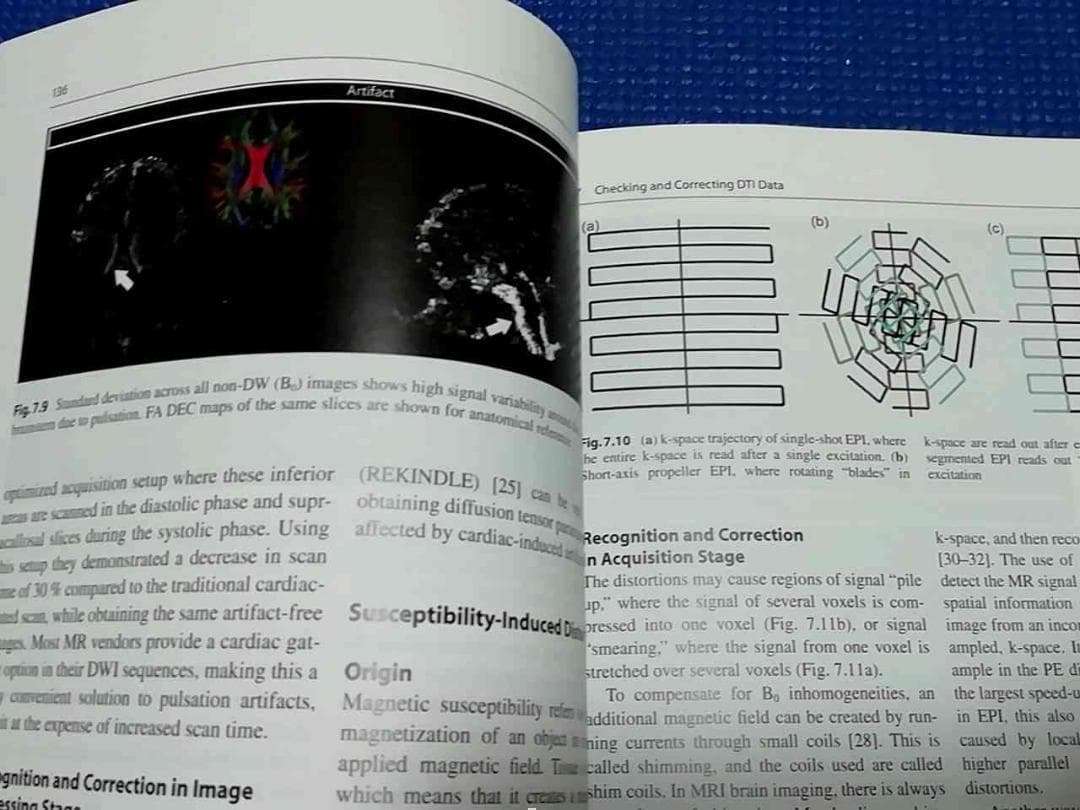 Diffusion Tensor Imaging 洋書