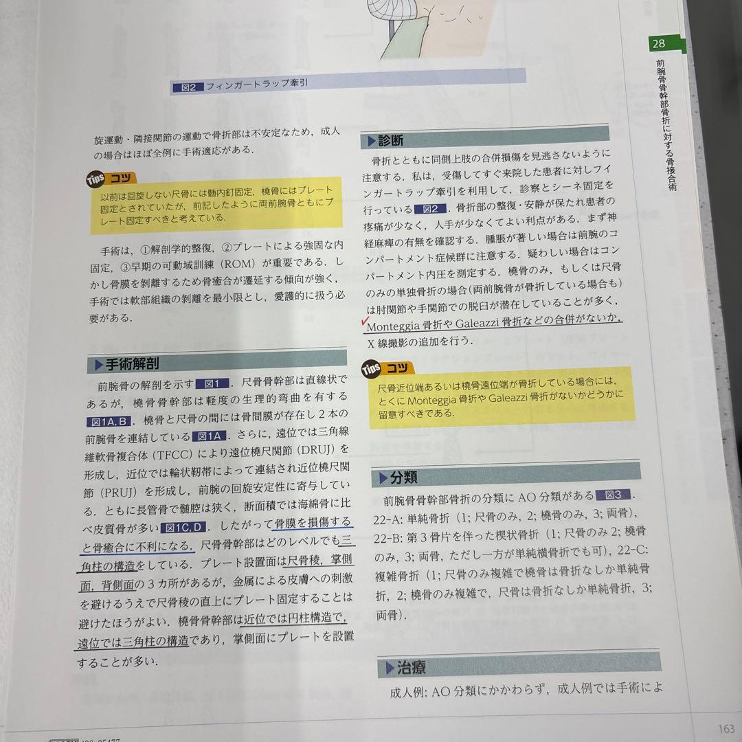 【裁断】手の外科私のアプローチ