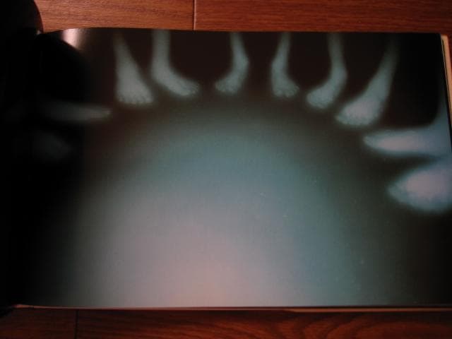 Lilly　志賀理江子　Lieko Shiga　初版