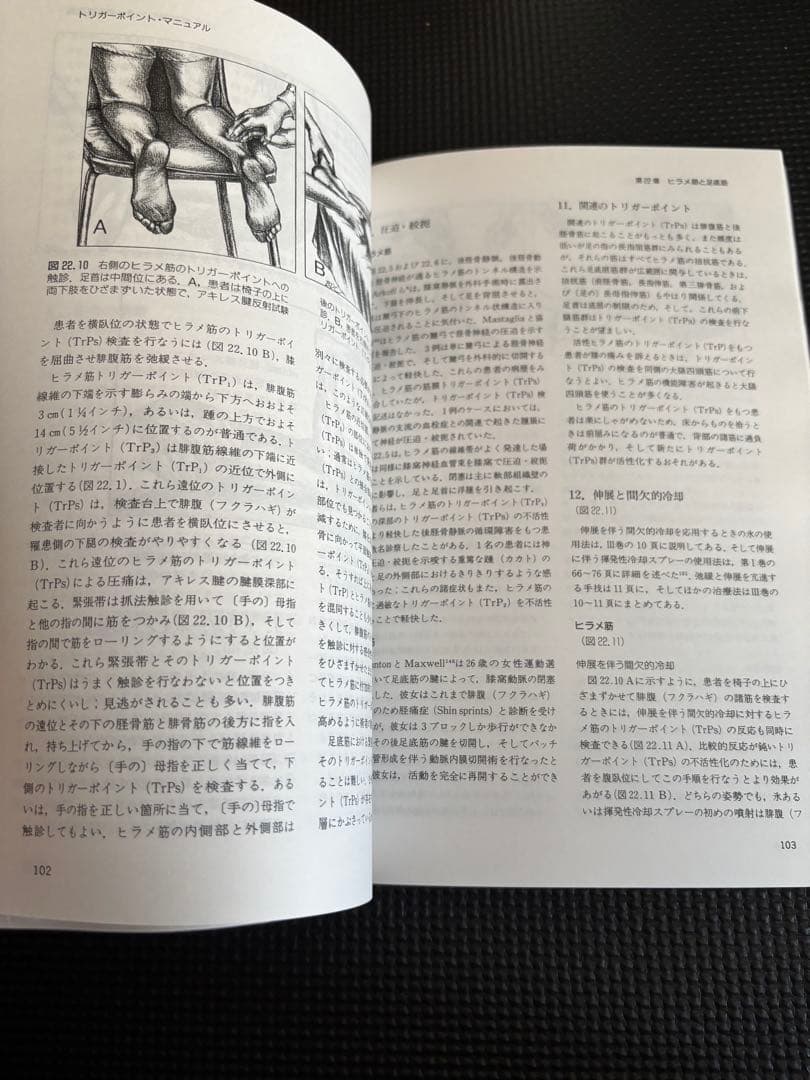 トリガーポイント・マニュアル 第IV巻　美品