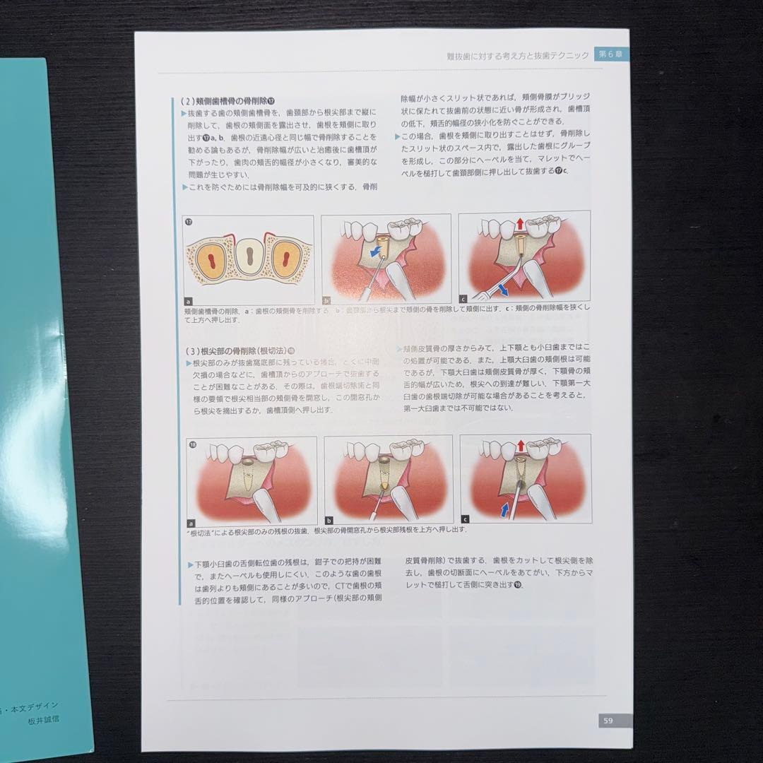 必ず上達 抜歯手技 増補新版