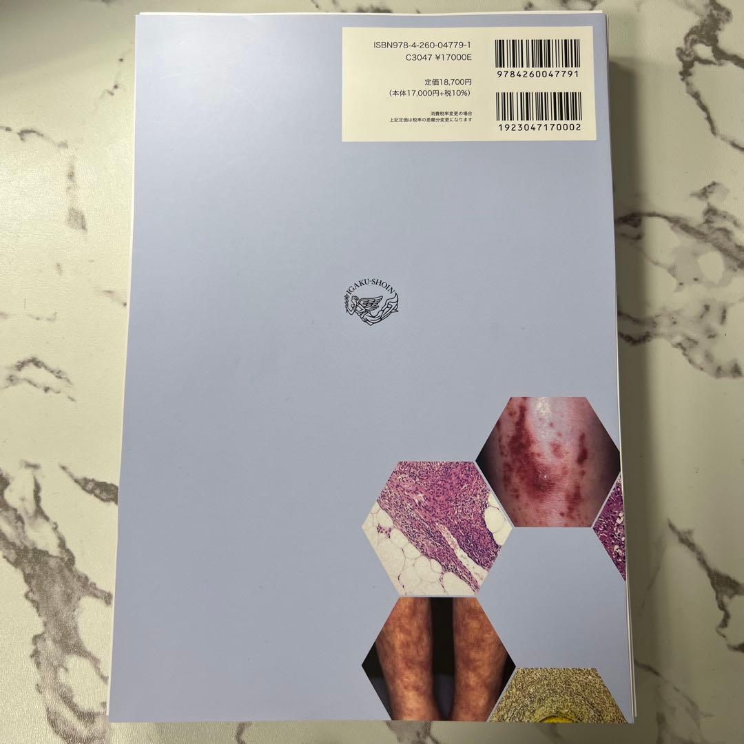 【裁断済み】皮膚血管炎